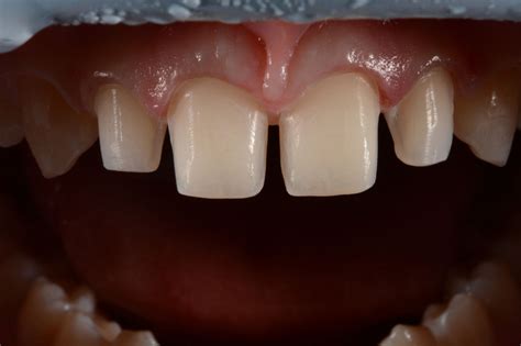 Facing thousands of free sci-fi novels, how do I find my next adventure?